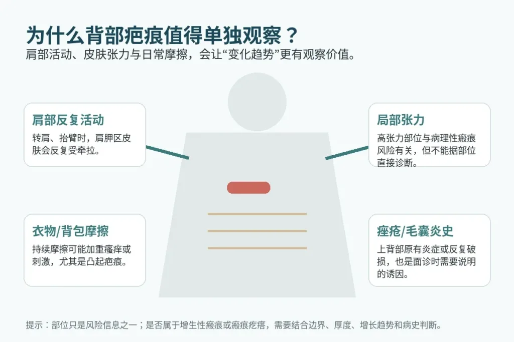 背部肩胛区活动、皮肤张力和衣物摩擦对疤痕观察的影响示意
