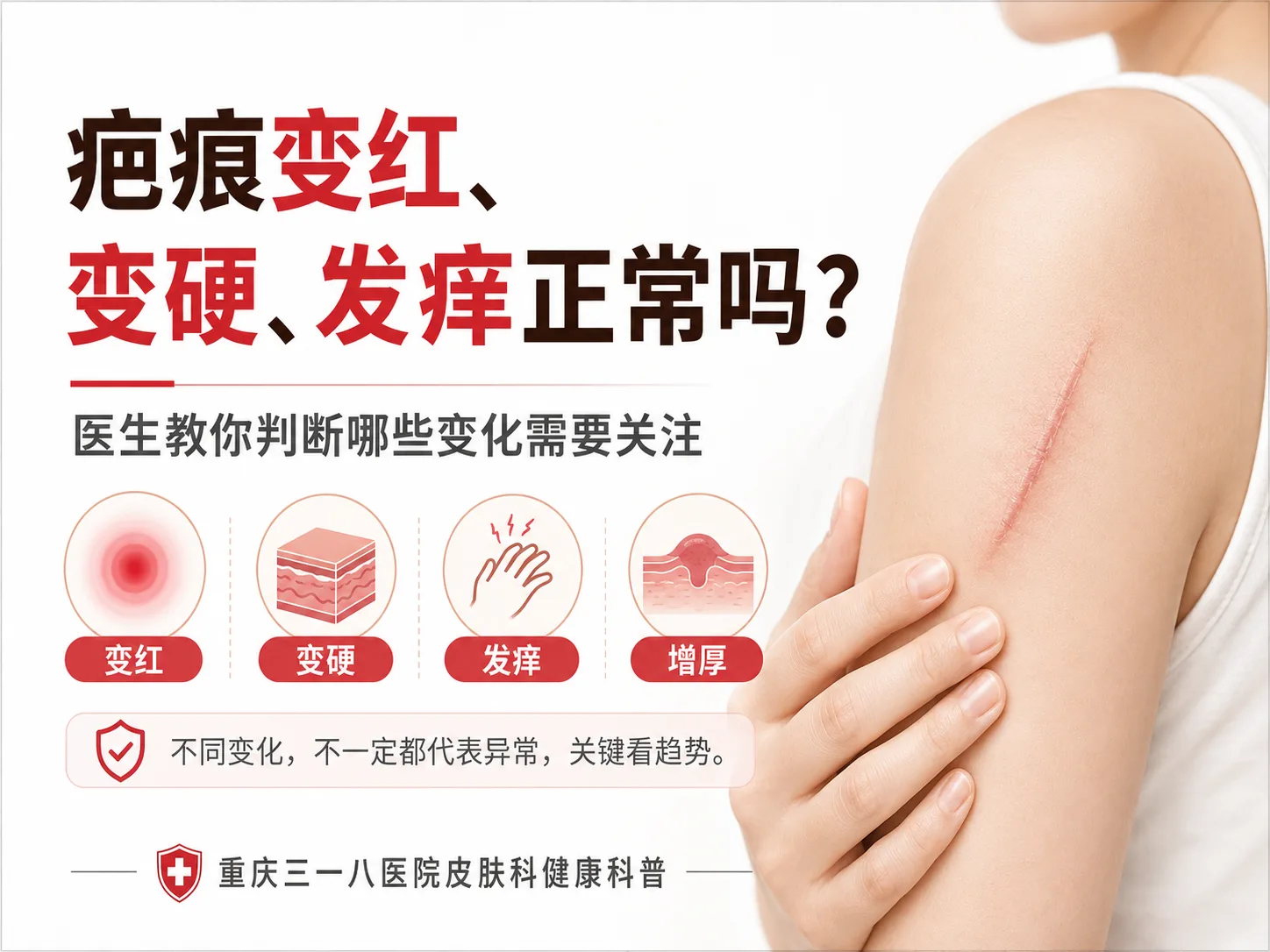 疤痕变红变硬发痒判断科普封面