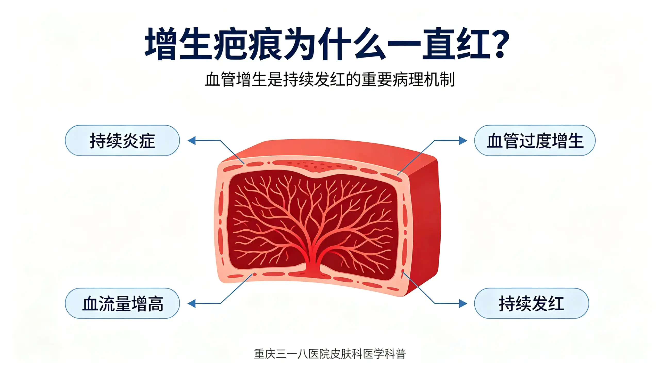 增生性疤痕血管增生与持续发红科普头图